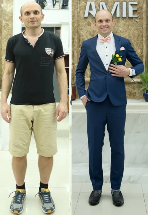 Trước & Sau may đo — Mon Amie